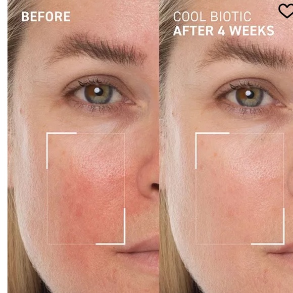 Dr. Brandt Cool Biotic Prebiotic Cream - Picture 2 of 5